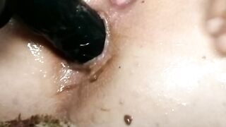 1st development of anal