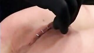 cuntwhipping stapler ache