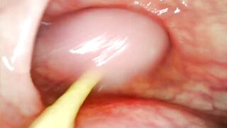 EXTRAORDINARY ANAL POV. CAMERA INSIDE HER BACKDOOR AS I POUND HER WITH MY LARGE ROD AND CUM UNFATHOMABLE INSIDE