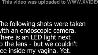 Missionary Screw and Some Ultra Close-Ups of a Freshly Drilled Snatch