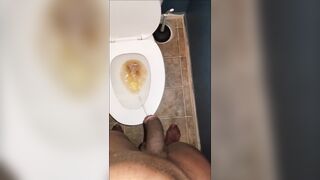 Just feeling nasty and taking a void urine