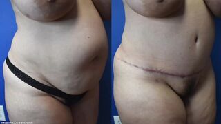 three Month In advance of & After