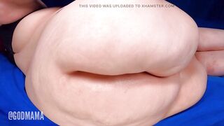 A1 Anal opening Widen two